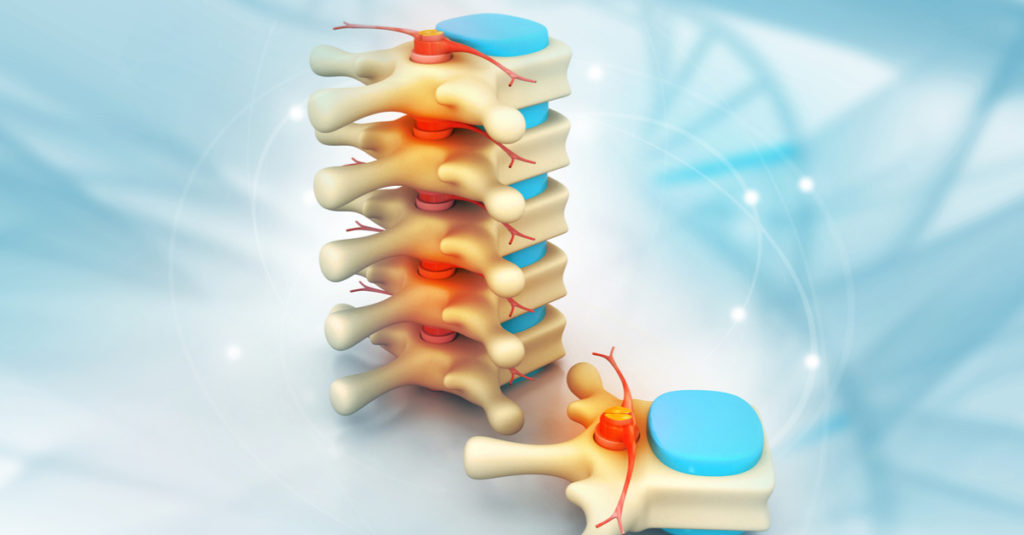 Understanding Minimally Invasive Spine Surgery Dr Virella
